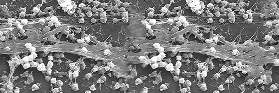 Factors to Consider as Legionella Outbreaks Continue